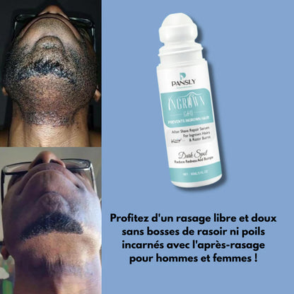 Sérum anti poils incarnés